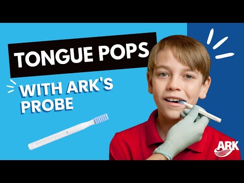 Ark Probe Video
